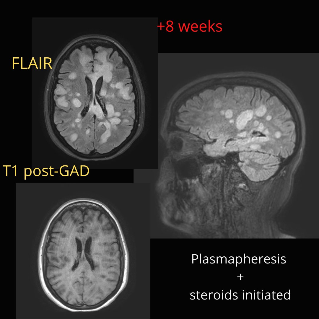 NeuroimagingN's tweet photo. https://t.co/zAqm6FfPDw