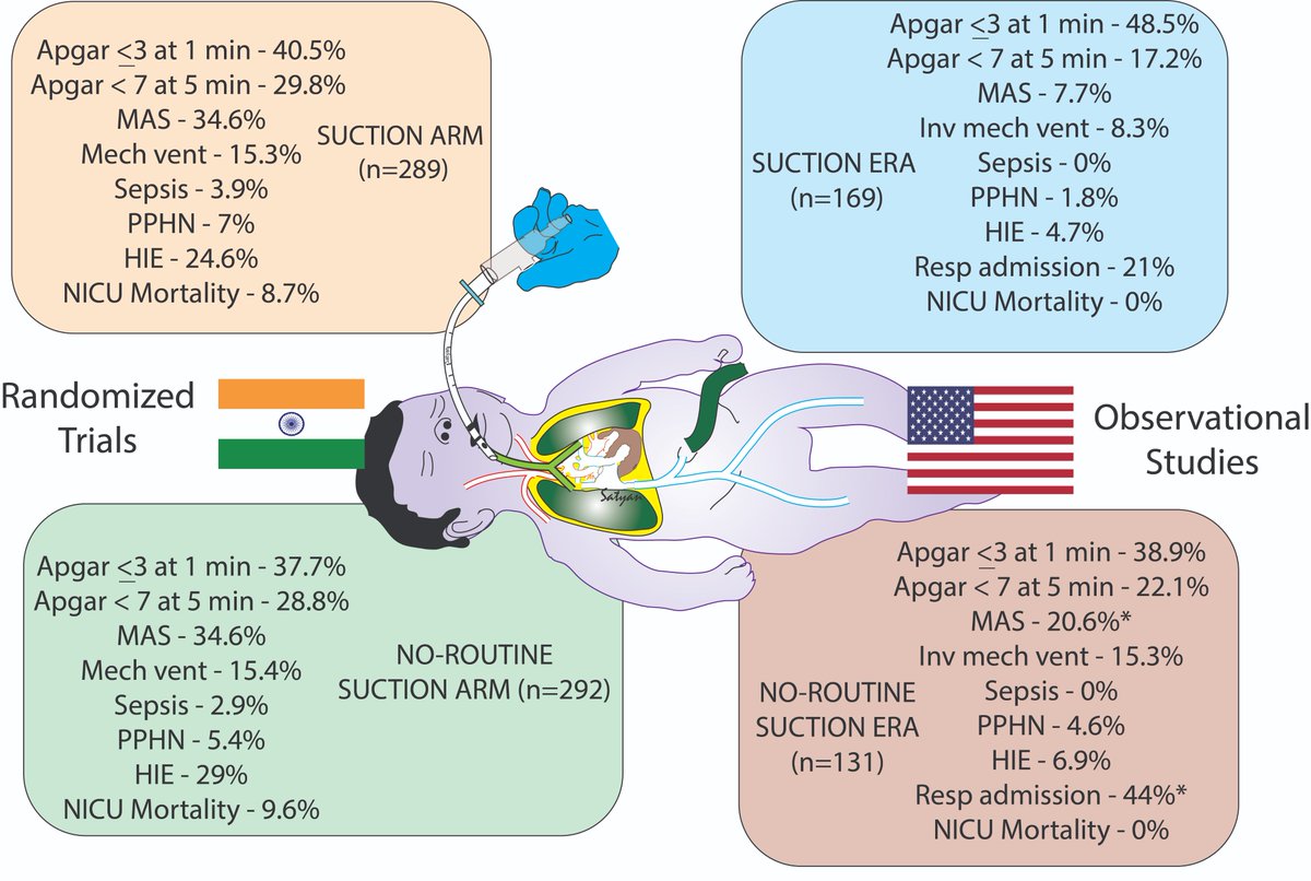 Satyan (@neosatyan) on Twitter photo MECONIUM CONTROVERSIES! No-routine suction+non-vigorous infants+meconium-stained amniotic fluid; Differences between Indian RCTs vs. US observational studies by <a href="/drarpineo/">Arpitha Chiruvolu MD</a> & <a href="/UCDavisChildren/">UCDavisChildrensHosp</a>-rdcu.be/cSXR2 more respiratory NICU admissions and MAS-Need for an RCT in US? MECONIUM CONTROVERSIES! No-routine suction+non-vigorous infants+meconium-stained amniotic fluid; Differences between Indian RCTs vs. US observational studies by <a href="/drarpineo/">Arpitha Chiruvolu MD</a> & <a href="/UCDavisChildren/">UCDavisChildrensHosp</a>-rdcu.be/cSXR2 more respiratory NICU admissions and MAS-Need for an RCT in US?