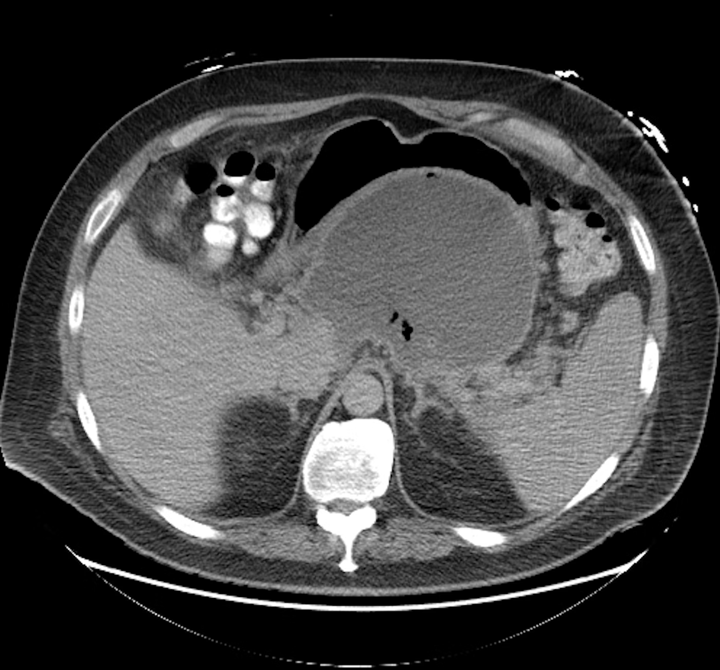 EndoCollab GI Endoscopy Community on Twitter "Twitter Quiz What is