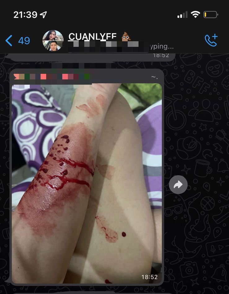 videtteolivia's tweet photo. ⚠️ TW : SELF HARM ⚠️
Banyak yang drop sampai masuk rumah sakit, keguguran, diusir dari rumah orang tua, cutting (menyileti tangan). https://t.co/QvNozHHKvo