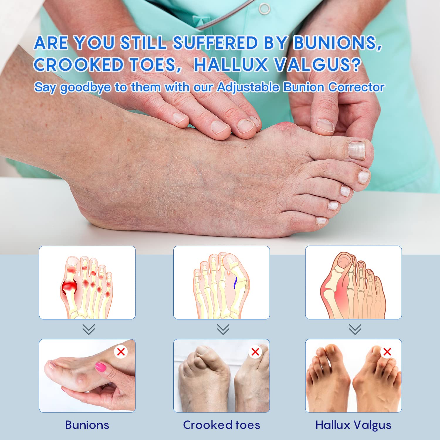 Fit Geno on Twitter "Are you suffering from bunion crooked toes? If so