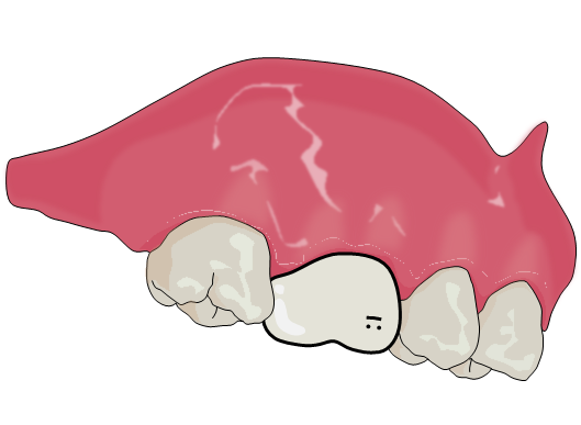 歯のイラストのtwitterイラスト検索結果