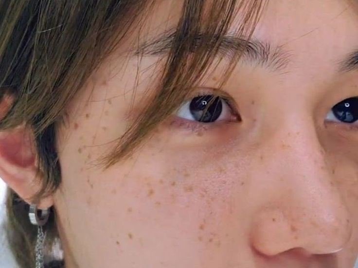 Stray kids threads | fan account on X: #Felix freckles appreciation : A thread #StrayKids #STAY https://t.co/IrxkoPJV2O / X Stray kids threads | fan account on X: #Felix freckles appreciation : A thread #StrayKids #STAY https://t.co/IrxkoPJV2O / X