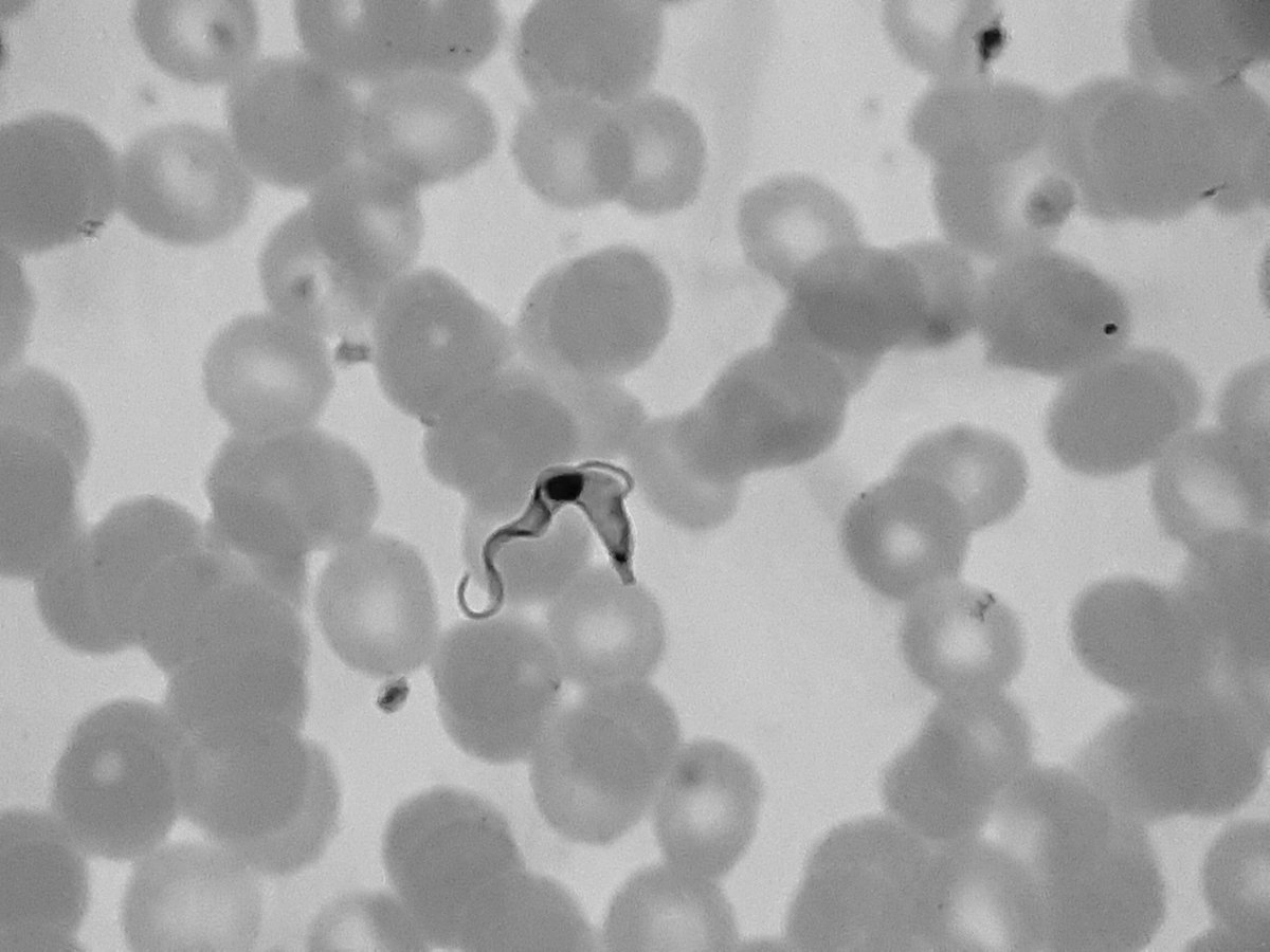 🔍Picture of the day: Trypanosoma brucei in a thin blood film collected from a traveler returning from East Africa with fever. #sleepingsickness #NTDs #trypanosomiasis