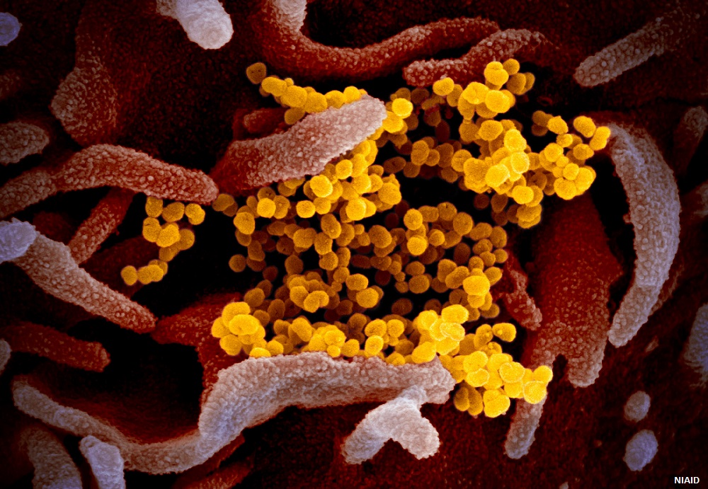 ScienceMagazine's tweet photo. A #nanotherapy for severe #COVID19 that targets inflammatory macrophages is safe and shows signs of alleviating neurologic injury and improving outcomes in hospitalized patients, shows a new phase 2a trial. @ScienceTM https://t.co/rqMPRILGLh https://t.co/JtNPr8e5FT