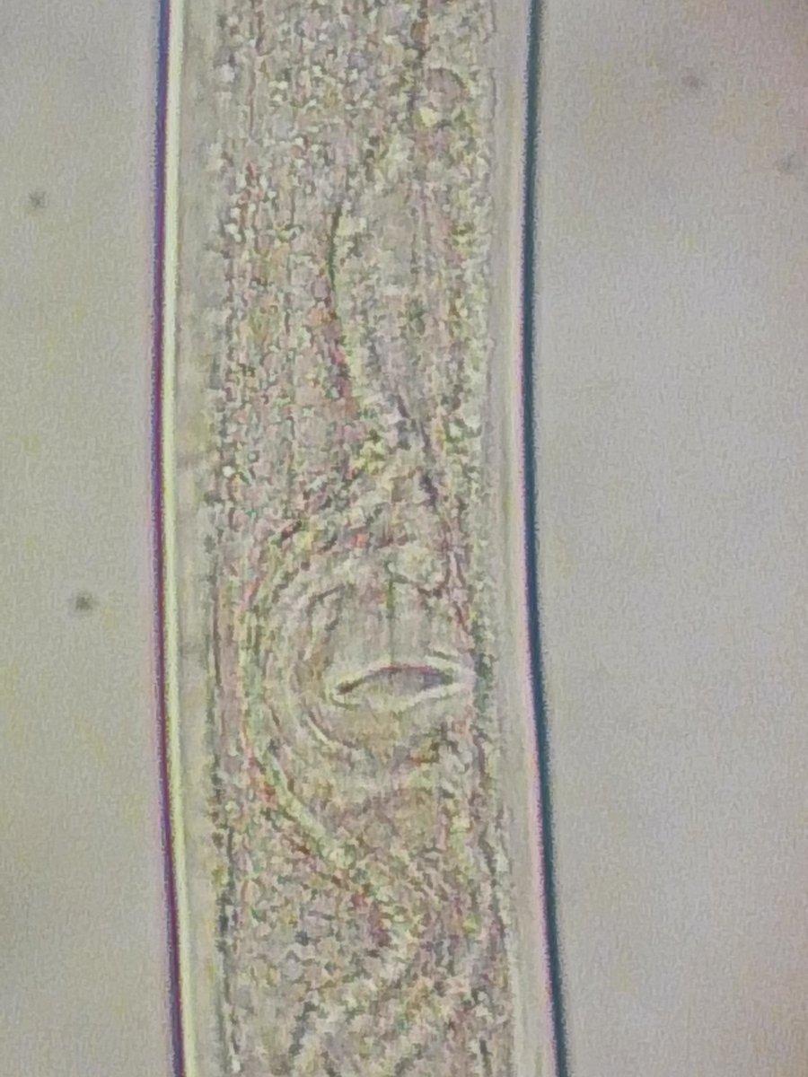 perichig's tweet photo. Hoy revisando unas muestras de café (suelo), observé varias hembras de #Xiphinema. En las fotografías, se puede apreciar: cuerpo, región anterior (odontoestilo y anillo guía), vulva y región posterior. Para Venezuela, se señalan 21 especies de este género. @activeplantnema. https://t.co/4Pwj4JnkRU