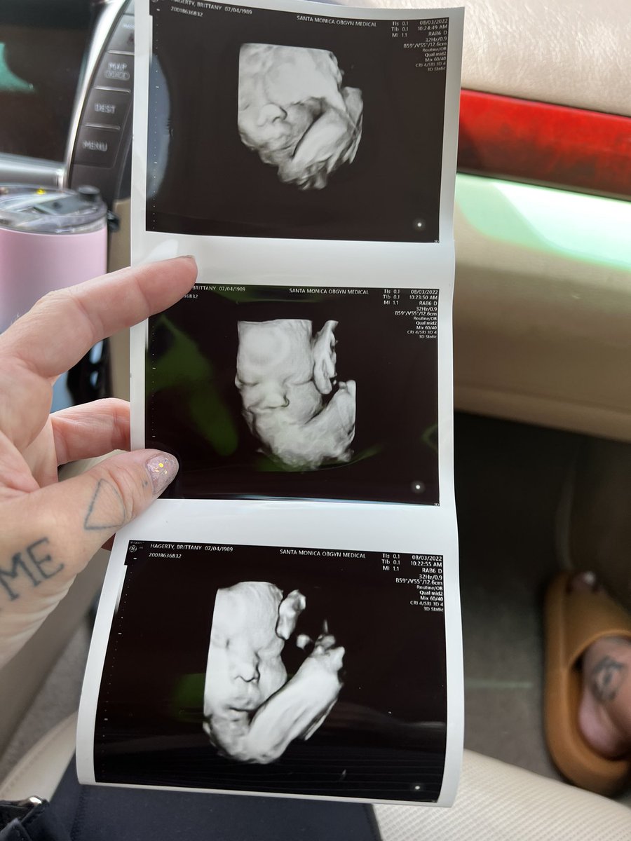 Our sweet baby girl is comfy in there! 🤞🏻🤞🏻 to see her soon! #40weekspregnant #pregnancy #ultrasound