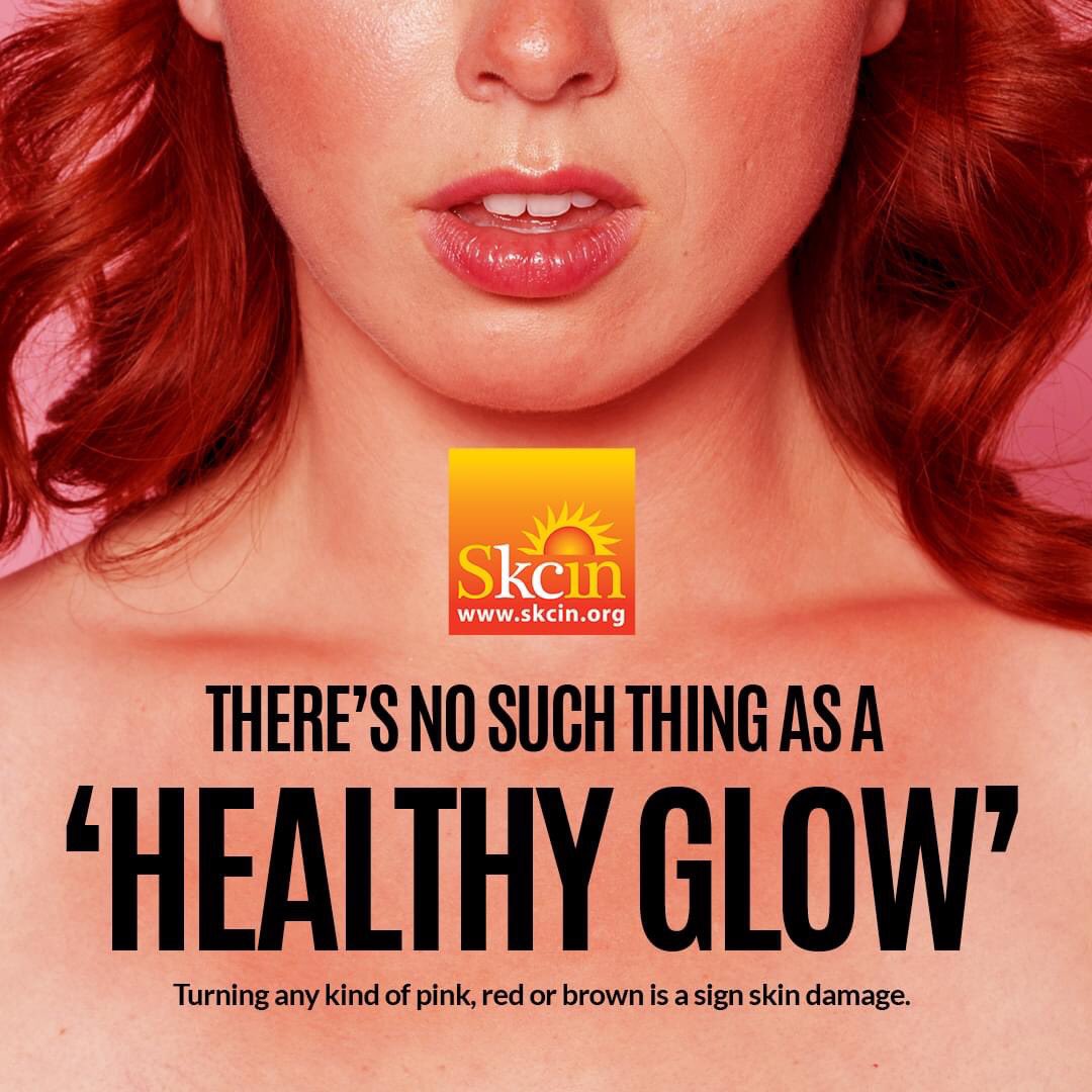SkcinCharity's tweet photo. When our skin changes colour, it is our body’s natural reaction to exposure to UV radiation. The pinky, reddish colouration caused by the skin’s adverse reaction also serves as a natural rouge, but be warned that UV radiation is penetrating deep into the skin. Make SPF your BFF! https://t.co/9Dw2aJTI2O