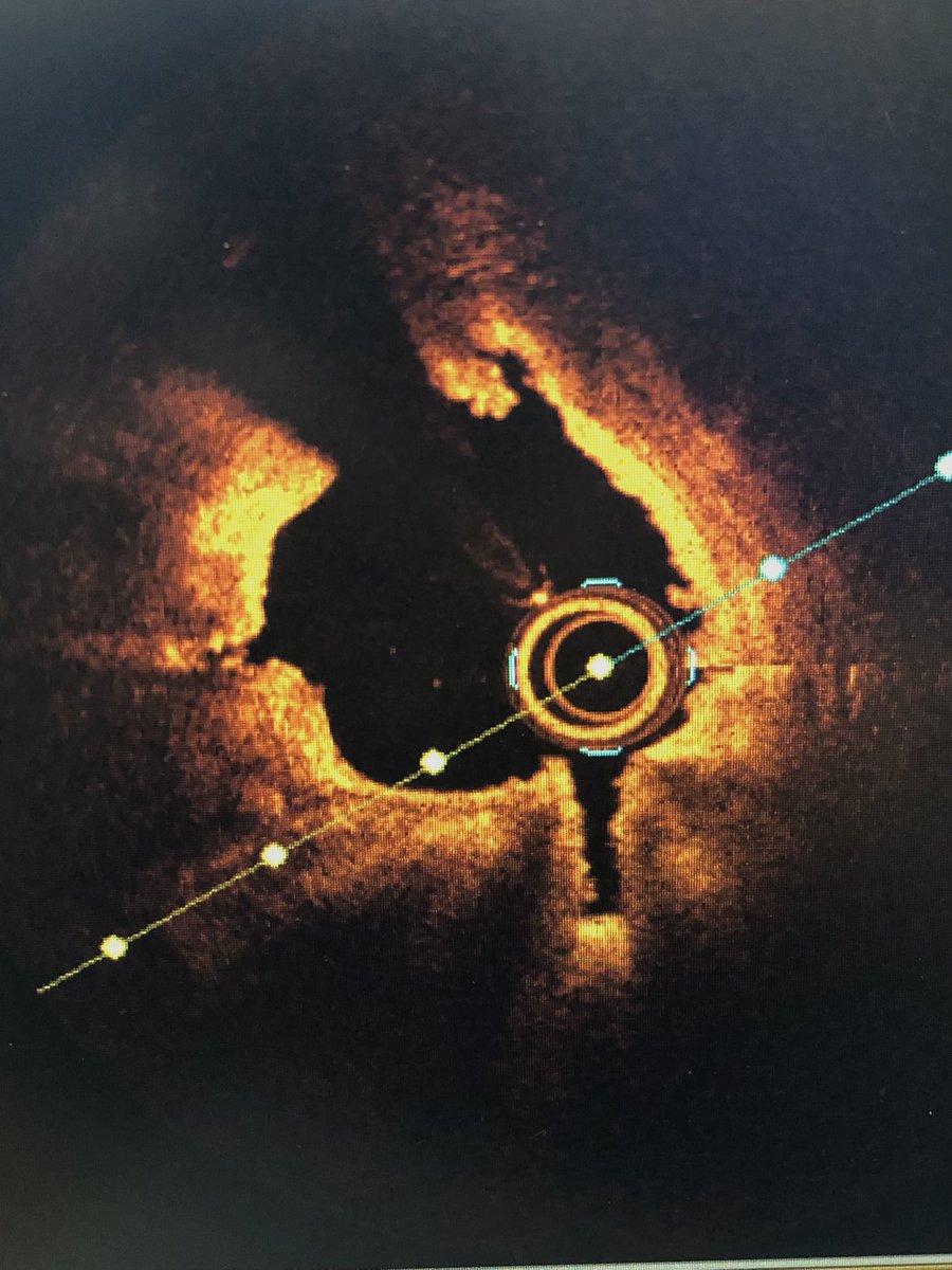 Richard Sohn MD tweet media