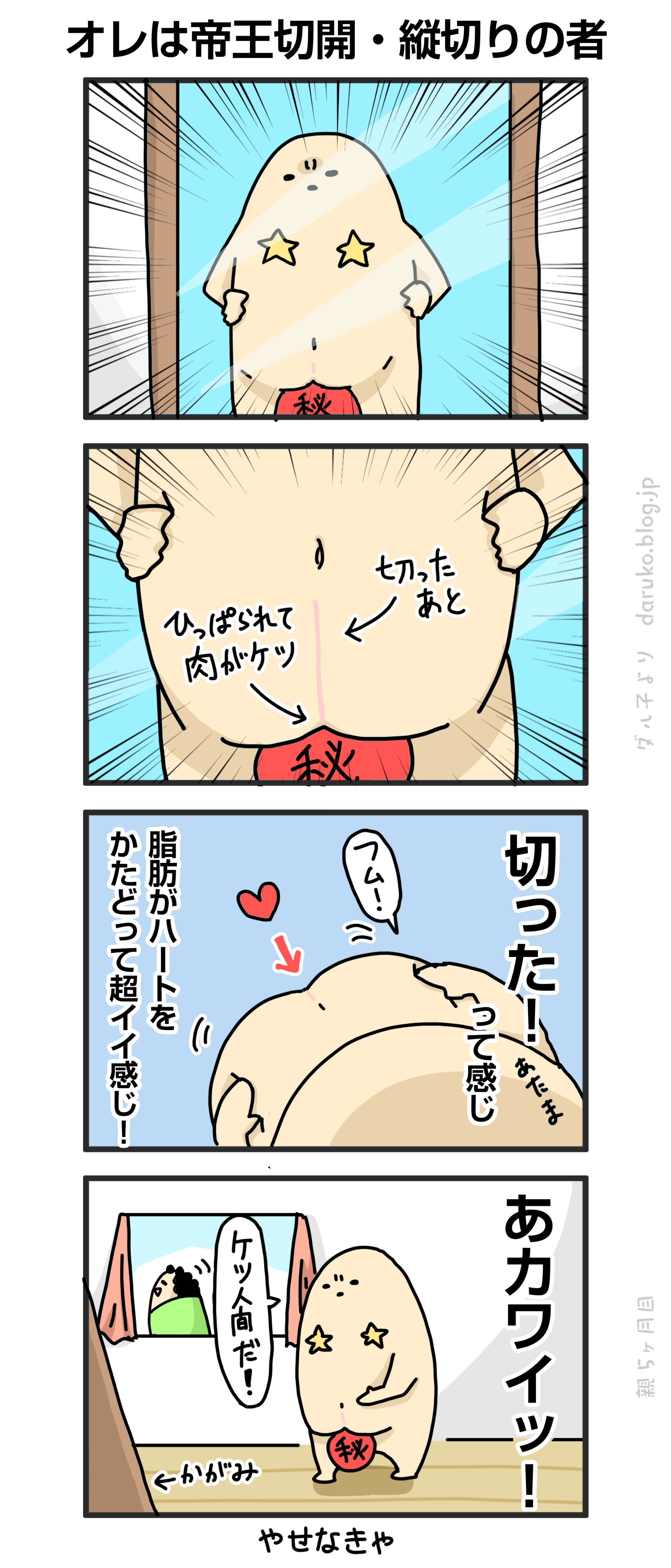 تويتر ダルダルのダル子 漫画 على تويتر 帝王の傷を見て T Co Ikyjfjgppm 帝王切開 出産 漫画 T Co V7ehtgc1my