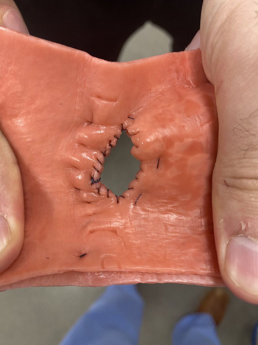 Robotic gastro-jejunostomy bio tissue drill. Is it perfect? No, but I’m proud of my progress over the past few months and excited to see how I improve in the future. Thankful I’m with a program that has the resources and capabilities to enable this growth. <a href="/UTSW_Surgery/">UTSW Surgery</a>