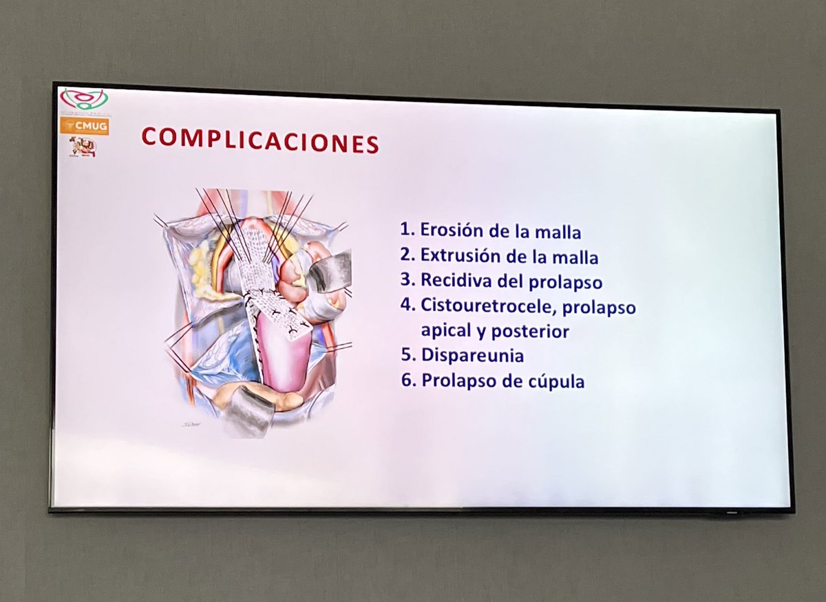 DoctorArriaga's tweet photo. Primer día del Congreso de Urología Ginecológica 2022: Taller de Cirugía para Prolapso De Órganos Pélvicos
#UroSoMe #CMUG #incontinence #urology https://t.co/vu6sqeEkLs