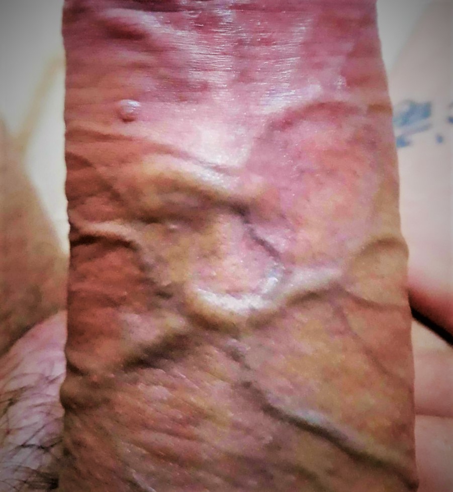 Alexfreeballing's tweet photo. Mapa do meu pau
Aula de anatomia
Quem quer se perder nele?
🍆😋😈🥰🔥😍🍆💦
#Paugrosso #pauzudos #PINTOAWARD #PINTOSASWARDS #pintoawardsgay #RETWEEET #RETWEEETME #RETWETT #paugostoso #19cm #meengole #mechupa #paugrande #veias #pau #roladura #rola #kct #Macro #zoom https://t.co/OEhRs1AOl1