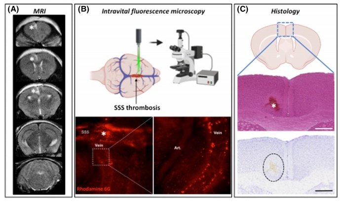 Everything you need to know about animal models of #CVST🧠 👏MC Bourrienne @Team6LVTSINSERM in @JTHjournal onlinelibrary.wiley.com/doi/full/10.11…