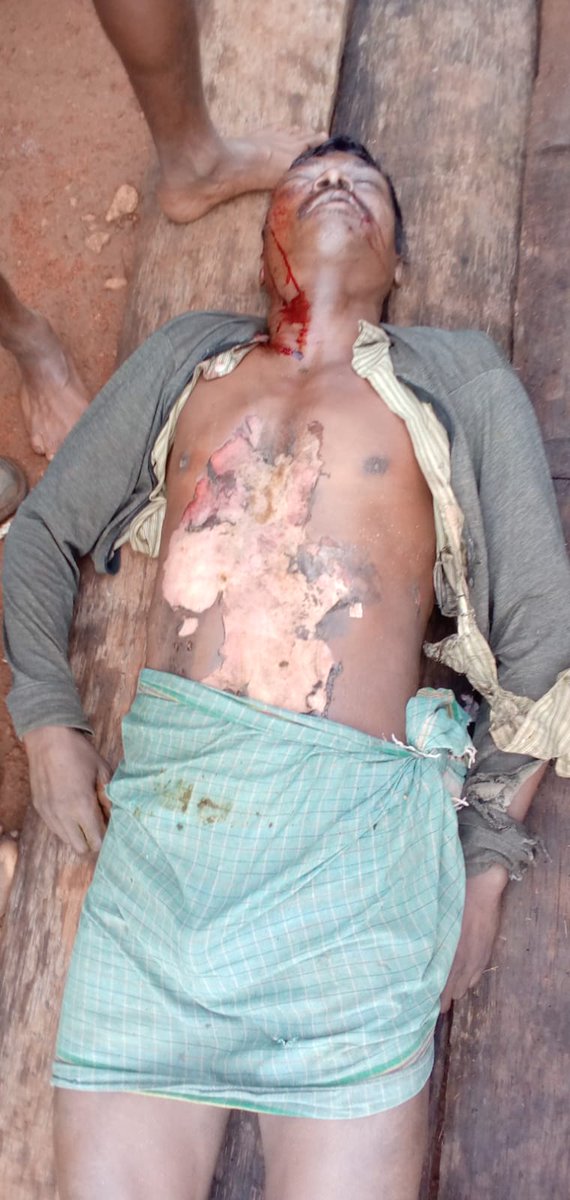 The dead body of Sanyasi Hantal (41) s/o- Dasu Hantal of Jumdang who died of lightning on 02.08.2022 was brought Chitrakonda SDH &amp; Post mortem is completed.