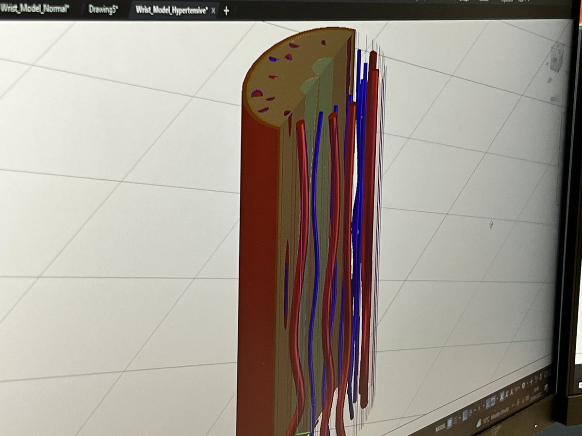 We’ve been busy! 
Our <a href="/BAOMSOfficial/">BAOMS</a> supported research is seeing amazing progress with <a href="/MarkMain_/">Mark Main</a>’s latest models are taking shape. Stay tuned for a detailed model! Blood vessels and the whole lot 😉
<a href="/UofGPhysAstro/">School of Physics & Astronomy, Uni. of Glasgow</a> <a href="/UofGARC/">UofGARC</a> <a href="/glasgowoptics/">Glasgow Optics Group</a>