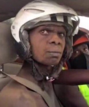 Pharmacist: sulfamethoxazole is the drug of choice in this situation               
                                                       Patient : Doc please I’m allergic to sulfa