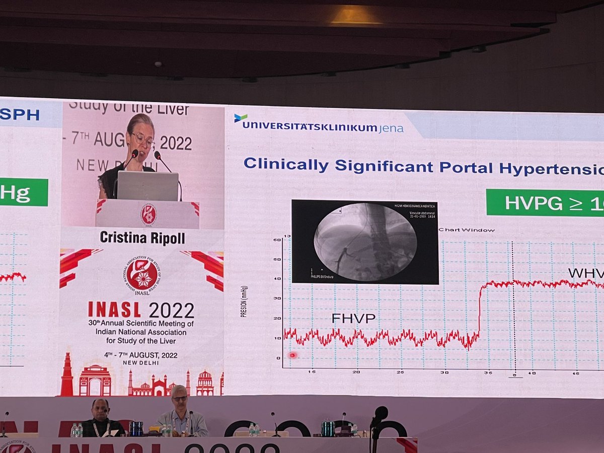 Sunil Taneja (@drsuniltaneja) on Twitter photo Cristina Ripoll taking about the cACLD -INASL 2022, New Delhi <a href="/ajay_duseja/">Ajay Duseja</a> <a href="/sahajrathi/">Sahaj Rathi MD, DM, MRCP</a> @nipun29j <a href="/docMPK/">M PREMKUMAR</a> <a href="/doc_arka/">Arka De</a> <a href="/DrArunKValsan/">Arun Valsan</a> Cristina Ripoll taking about the cACLD -INASL 2022, New Delhi <a href="/ajay_duseja/">Ajay Duseja</a> <a href="/sahajrathi/">Sahaj Rathi MD, DM, MRCP</a> @nipun29j <a href="/docMPK/">M PREMKUMAR</a> <a href="/doc_arka/">Arka De</a> <a href="/DrArunKValsan/">Arun Valsan</a>