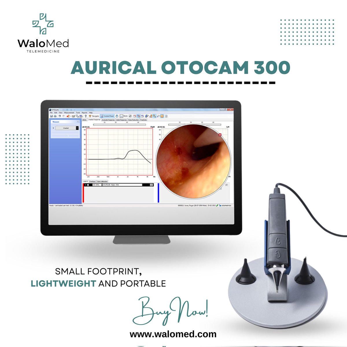 Walomed_'s tweet photo. Aurical Otocam 300

Start your e-learning journey with us today👨‍💻

For More Details Contact Us:
☎️: +1 504 313 4085

Or visit our website 
🌍: https://t.co/HwgDutAmsr
#elearning #education #learning #knowledge  #technology #espoirglobal #healthcare #onlinelearning https://t.co/K2DeP2bnwB