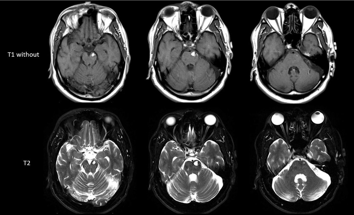Jacques Morcos MD FRCS FAANS tweet media