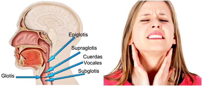 Acerca de Que Es Edema De Glotis Último Acerca de Que Es Edema De Glotis Último