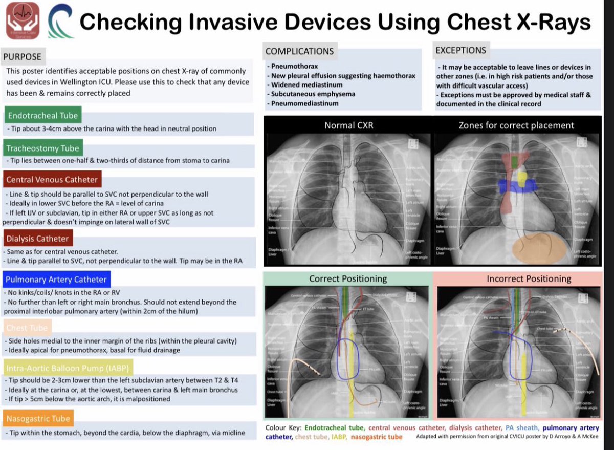 Medical_MD1's tweet photo. Quick Guide 🧐

How to Interpret a Chest X-ray ✨

. https://t.co/e33RVT3g1L