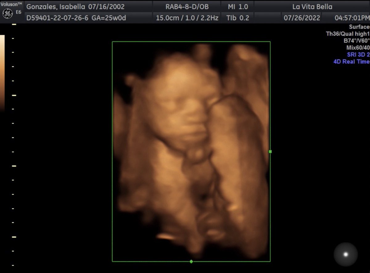 bellllla_bae12's tweet photo. I can’t wait for my baby boy to be here. #14weeksleft 🥰🥹 https://t.co/pOmSzynXuY