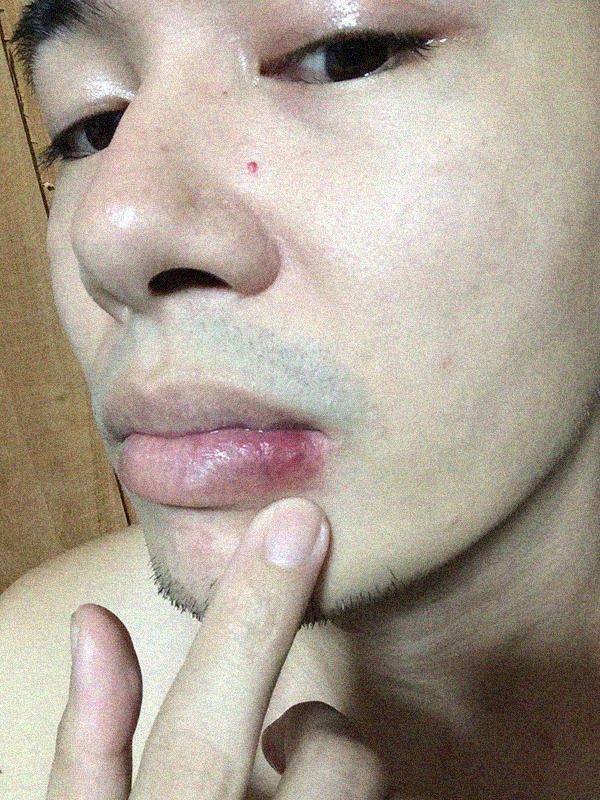 BossJeppTV's tweet photo. Minsan na nga lang may kumagat sa labi ko, insekto pa. -_- https://t.co/660QqaP35g