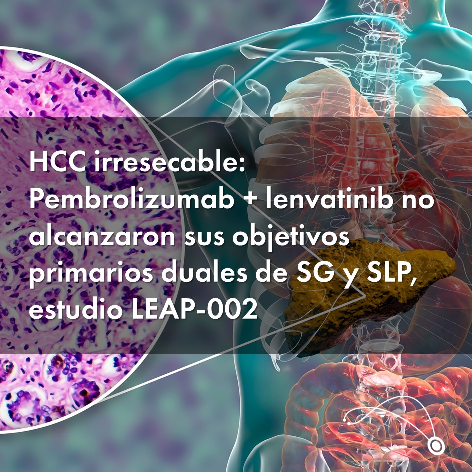 sciencelinkonco's tweet photo. #Pembrolizumab #Lenvatinib #LEAP002 #ScienceLink
HCC irresecable: Pembrolizumab + lenvatinib no alcanzaron sus objetivos primarios duales de SG y SLP, estudio LEAP-002
https://t.co/befiTiEmmF https://t.co/mjzC7Nfoxa