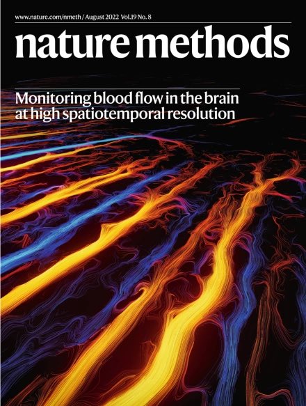 Tanter Mickael (@tanterm) on Twitter photo Last but not least, many thanks to <a href="/naturemethods/">Nature Methods</a> for choosing #fULM for its cover this month and <a href="/AlexandreDizeux/">Alexandre Dizeux</a> for his great artwork ! Thanks <a href="/ESPCI_Paris/">ESPCI Paris - PSL</a> <a href="/inserm/">Inserm</a> <a href="/cnrs/">CNRS π</a> <a href="/psl_univ/">UniversitΓ© PSL</a> <a href="/AXAResearchFund/">AXA Research Fund</a> for making this research happen ! Last but not least, many thanks to <a href="/naturemethods/">Nature Methods</a> for choosing #fULM for its cover this month and <a href="/AlexandreDizeux/">Alexandre Dizeux</a> for his great artwork ! Thanks <a href="/ESPCI_Paris/">ESPCI Paris - PSL</a> <a href="/inserm/">Inserm</a> <a href="/cnrs/">CNRS π</a> <a href="/psl_univ/">UniversitΓ© PSL</a> <a href="/AXAResearchFund/">AXA Research Fund</a> for making this research happen !