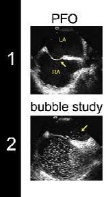 Arvin Narula tweet media