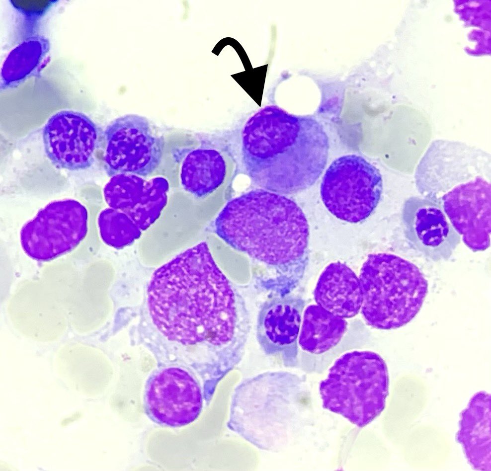 What hematopoietic cell is this one? 