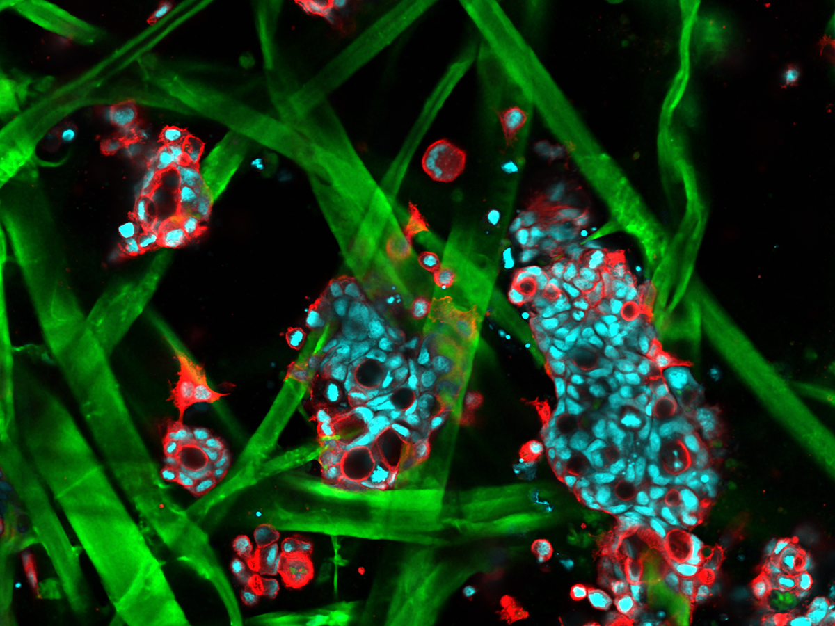 📷📸
#ScienceExposed Top 20 is back!

To vote for Simon Latour's image
[Cancer cells swimming in a microscopic paper forest] 
for the 2022 People’s Choice Award 🏆:

Click here ▶️ tinyurl.com/5779p9c9

.
<a href="/UofT/">University of Toronto</a> <a href="/SimonLatour3/">Simon Latour</a> <a href="/mcguiganlab/">mcguiganlab</a>