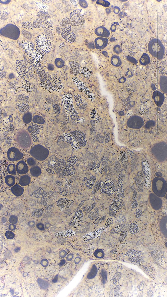 BarbieriSue's tweet image. Gag transitioning from female to male, aboriginal art Alma Nungarrayi Granites Australian (Warlpiri, Central/Western Desert)