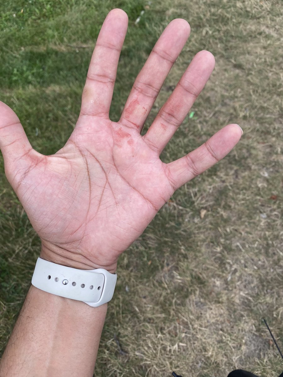 Here are the pics. How does the police just not show up? Is this not their job? What do we pay taxes for? Do we pay taxes for <a href="/TorontoPolice/">Toronto Police</a> to pick and choose which crimes they attend to? Would it be different if it was a white woman in their 30s? <a href="/JohnTory/">John Tory</a> this is #Toronto