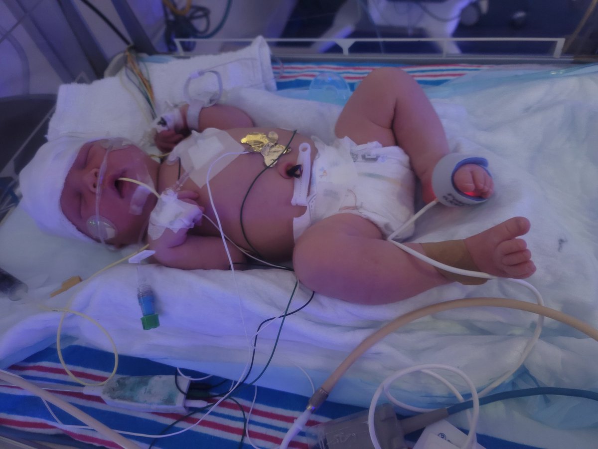 Welcomed my baby girl Evangelynn Grace into the world on Tuesday. 7lbs 11 Oz born at 8am on the dot! 
My little beautiful girl is in the NICU waiting for answers she keeps having apnea episodes and has stopped breathing multiple times. Prayers for my baby girl appreciated! 💝💝