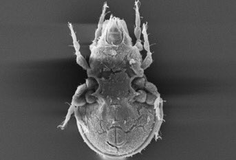 acarological's tweet photo. First record of the mite family Nosybeidae (Acari, Oribatida) from Turkey: Lamellocepheus personatus https://t.co/3sIaHsrJVU #acari #mites #arachnida #lamellocepheus https://t.co/eh5jr0RbDI
