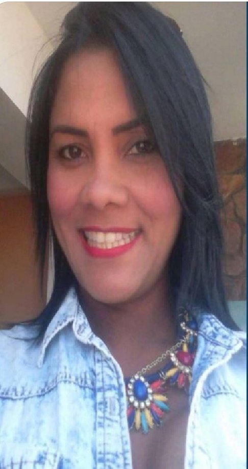 LuisSomaza's tweet photo. Necesitamos vencer la censura y que todos sepamos que ella es Emirlendriz Benítez, una víctima de la dictadura y de la DGCIM que estaba embarazada al momento de su detención, le provocaron un aborto y la dejaron en silla de ruedas. Hoy a ella la sentenciaron a 30 años https://t.co/n42CbOZ1ky
