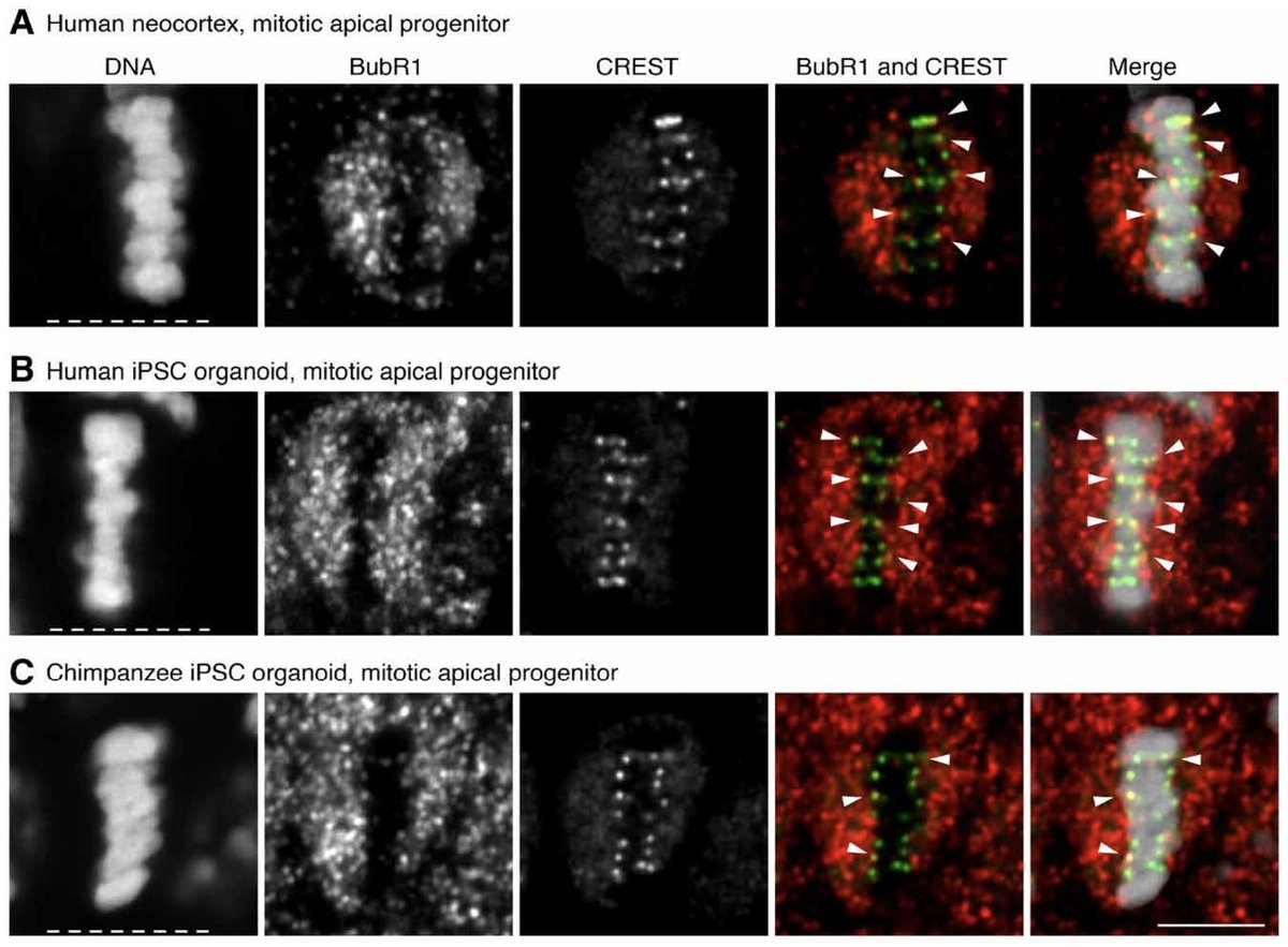 ScienceMagazine's tweet photo. Compared with archaic humans and apes, modern humans experience fewer chromosome inheritance errors when their brains develop, according to a new study in @ScienceAdvances. https://t.co/O4NoeTk8fV #Genetics https://t.co/9070sauuHa