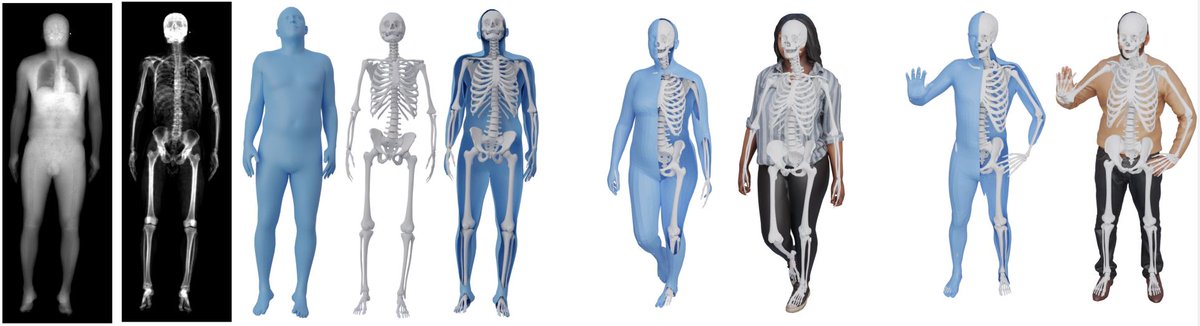 Fun/exciting paper I came across! Predicting skeleton anatomy from images of the body surface. I would <3 to see this working on a hololens with real time skeleton overlays on other people in the room. openaccess.thecvf.com/content/CVPR20…