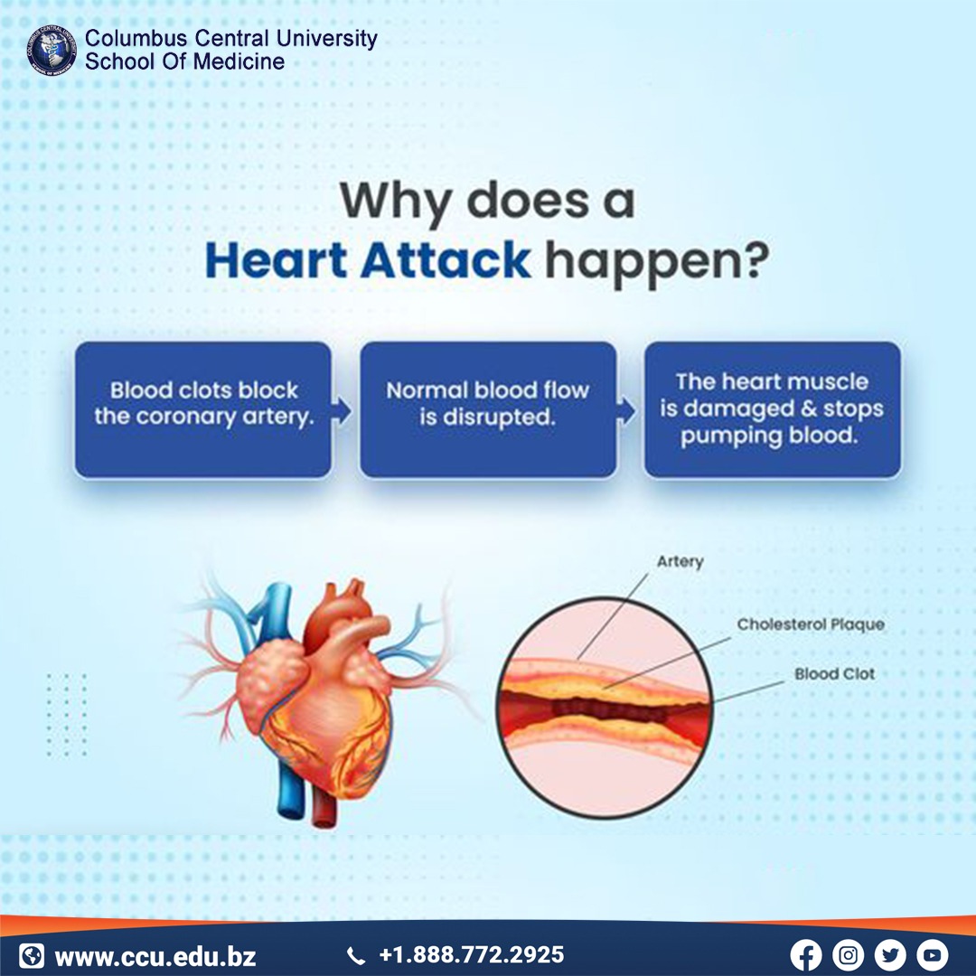 columbus_univ's tweet photo. Did you know the actual reasons of heart attack?
.
.
.
#CCU #columbuscentraluniversity #warmingminds #questiongame #medicalcollege #explore #sciencequestion #knowledge #university #universitylife #college #collegelife #college #scientific #scienceworld #training #experiment https://t.co/p02aJ7cp3g