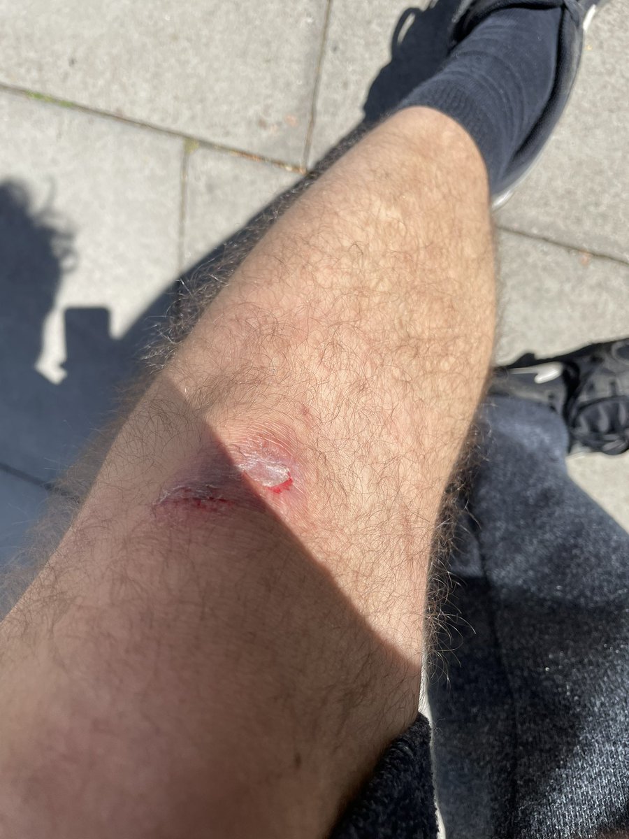 lainasemanuel's tweet photo. @limebike I was involved in an accident because the seat fell off mid ride on one of your bikes and all you present me is with a standard form and a “Thank you for your feedback”? https://t.co/Silvegnjc2
