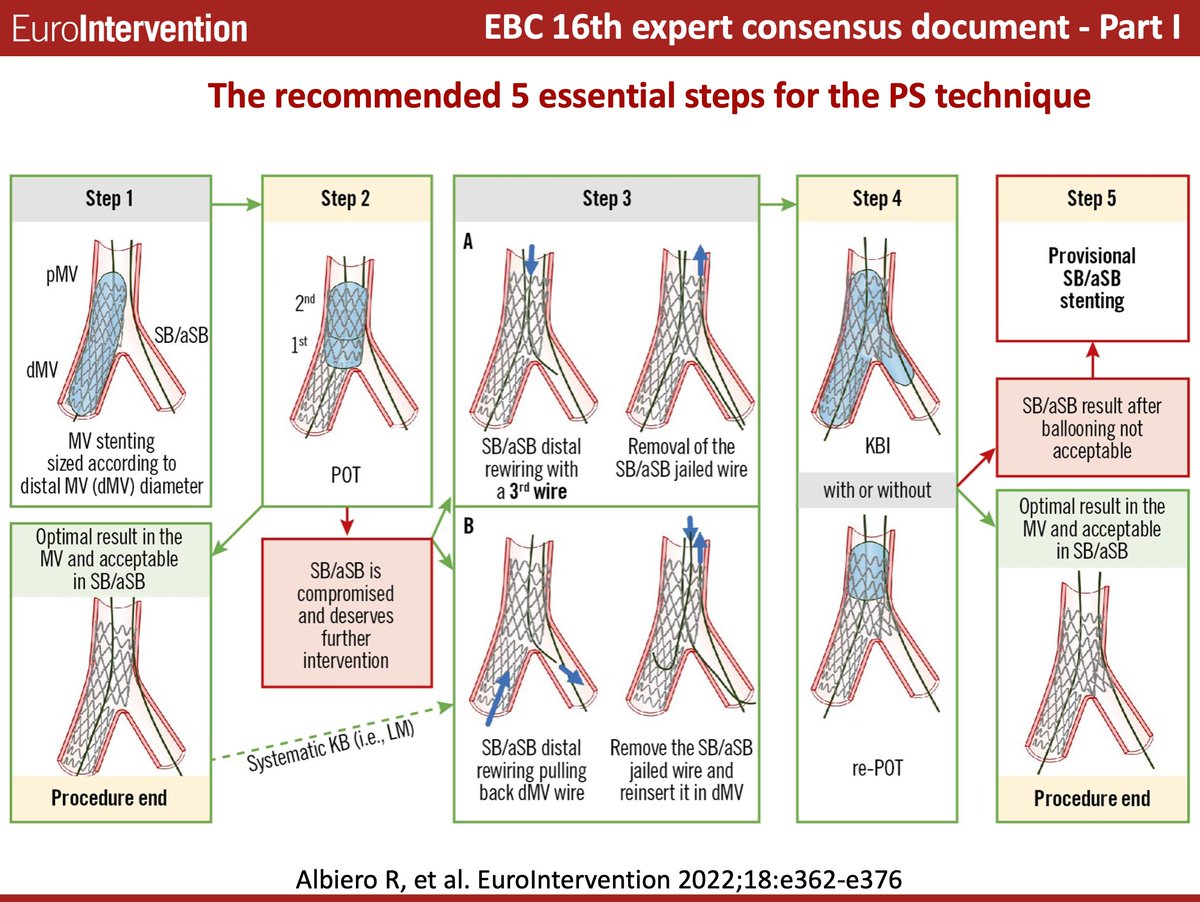 Part I of the 16th EBC CONSENSUS PAPER provides a detailed step-by-step overview of the pitfalls and technical troubleshooting during the implantation of the first stent using the PS strategy for the treatment of coronary bifurcation lesions. #EAPCI  ow.ly/vQms50Kc4NZ