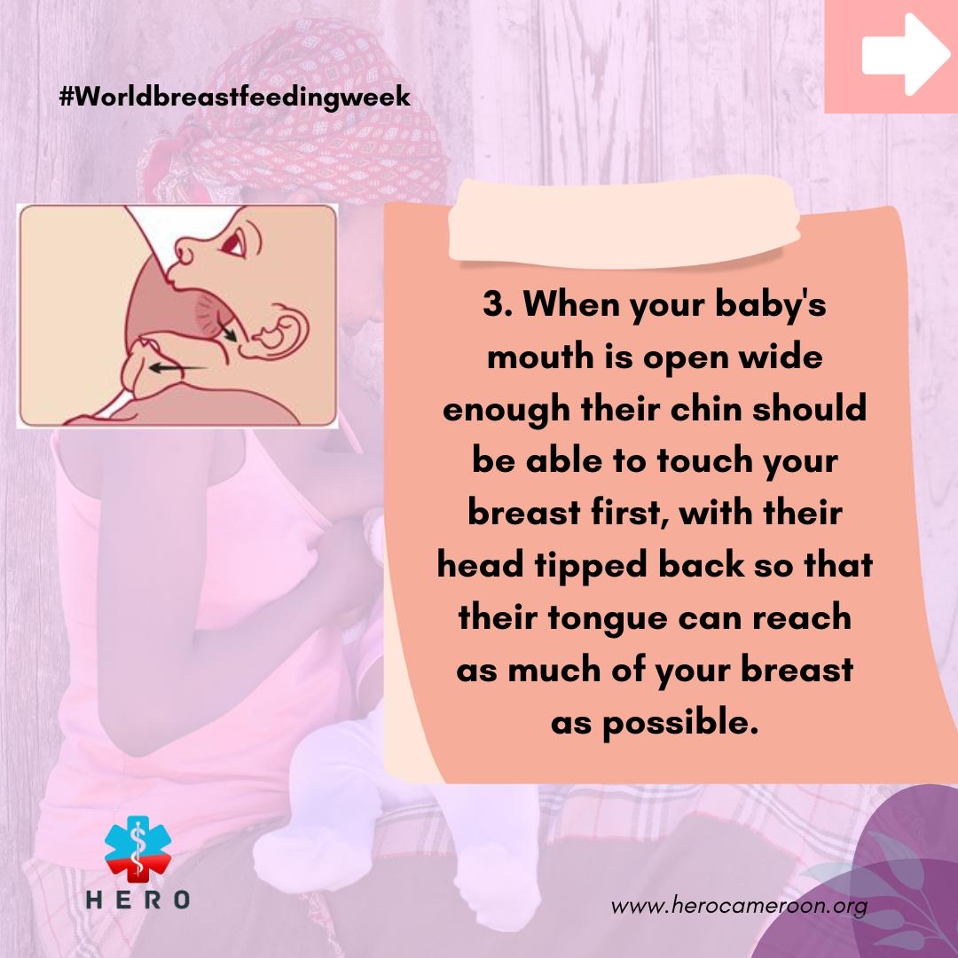Are you a new mum? 
Have you been struggling to get your baby to latch?
Here are a few tips for you.

#WBW2022 
#WorldBreastfeedingWeek 
#StepUpForBreastfeeding 
#HeroCameroon