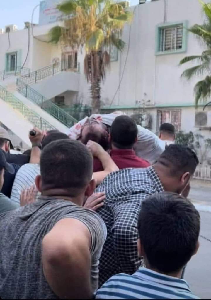 Asthetic_idiots's tweet photo. Breaking|| About 15 Palestinians wounded in a series of Israeli airstrikes on separate targets in the Gaza Strip.
#غزه_تحت_القصف https://t.co/ziooKkxWcU