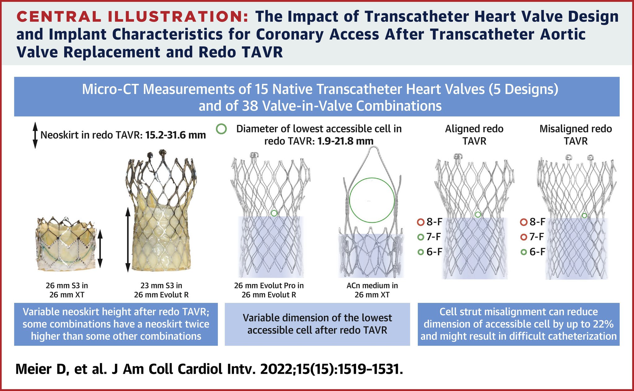 Evolut R Sizes Tavr For St Jude Trifecta Replacement – TWYZ