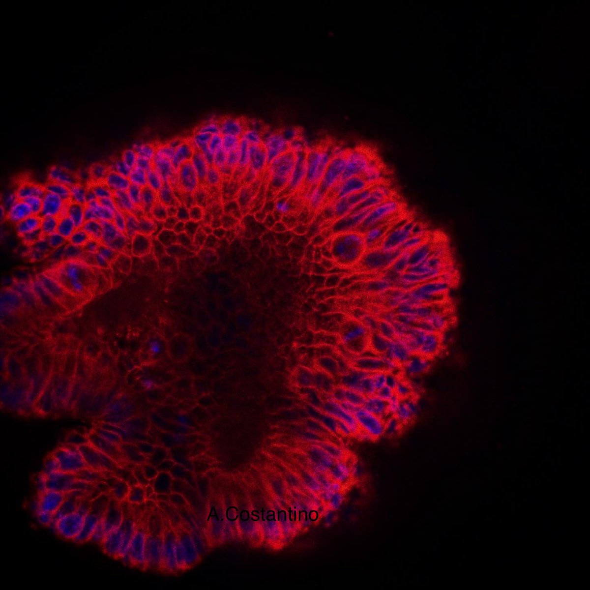 CostanAngelita's tweet photo. Last Lab Day before Summer Holidays 🏝 See you soon my babies!🧫❤️ #intestinalorganoids #adultstemcells #confocalmicroscopy #liveimaging #stemcellbiology https://t.co/5IKP05VNeS