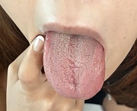 セレブ女社長さんのこってり舌苔です💛  コーヒーと煙草が好きなようで、黄ばんでおります  期間限定でセット商品がお買い得になっております。 https://t.co/9nn3Blgsj3 https://t<a href="/tag/%E7%97%B4%E5%A5%B3"class="tags"><span>#痴女</span></a><a href="/tag/%E8%88%8C%E3%83%95%E3%82%A7%E3%83%81"class="tags"><span>#舌フェチ</span></a><a href="/tag/%E5%94%BE%E3%83%95%E3%82%A7%E3%83%81"class="tags"><span>#唾フェチ</span></a><a href="/tag/%E5%8C%82%E3%81%84%E3%83%95%E3%82%A7%E3%83%81"class="tags"><span>#匂いフェチ</span></a><a href="/tag/%E8%87%AD%E3%81%84%E3%83%95%E3%82%A7%E3%83%81"class="tags"><span>#臭いフェチ</span></a><a href="/tag/%E9%BC%BB%E8%88%90%E3%82%81"class="tags"><span>#鼻舐め</span></a>