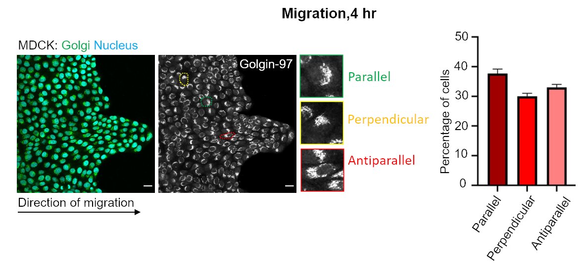 2/n) In the collectively migrating epithelium, we found that the Golgi polarity showed three distinct orientations with respect to the direction of migration; Parallel, Perpendicular, and Antiparallel.