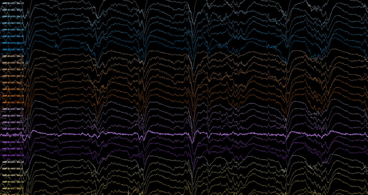 NeuroAlc's tweet photo. #SciencePhoto_IN
"Never ending synchronicity"
Author: Dra. María Sáez @saezgam
Lab: Dr. Ramón Reig @RamonReig2
"Electrophysiological multielectrode recording in prefrontal and visual cortices in an anesthetized mouse. Recorded with Neuronexus @neuronexustech." #slowwave https://t.co/pV0buLCQaw